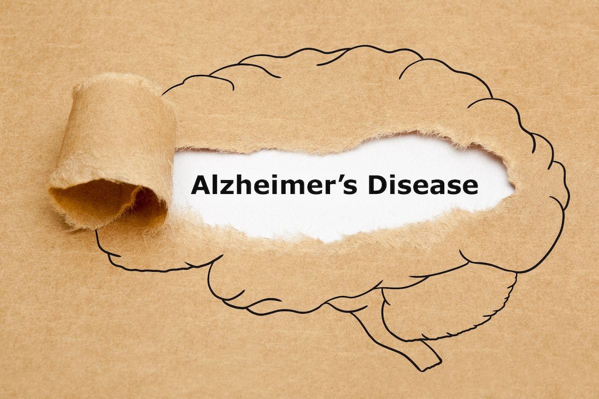 Image of torn brain with words "Alzheimer's disease" ©Ivelin Radkov-stock.adobe.com