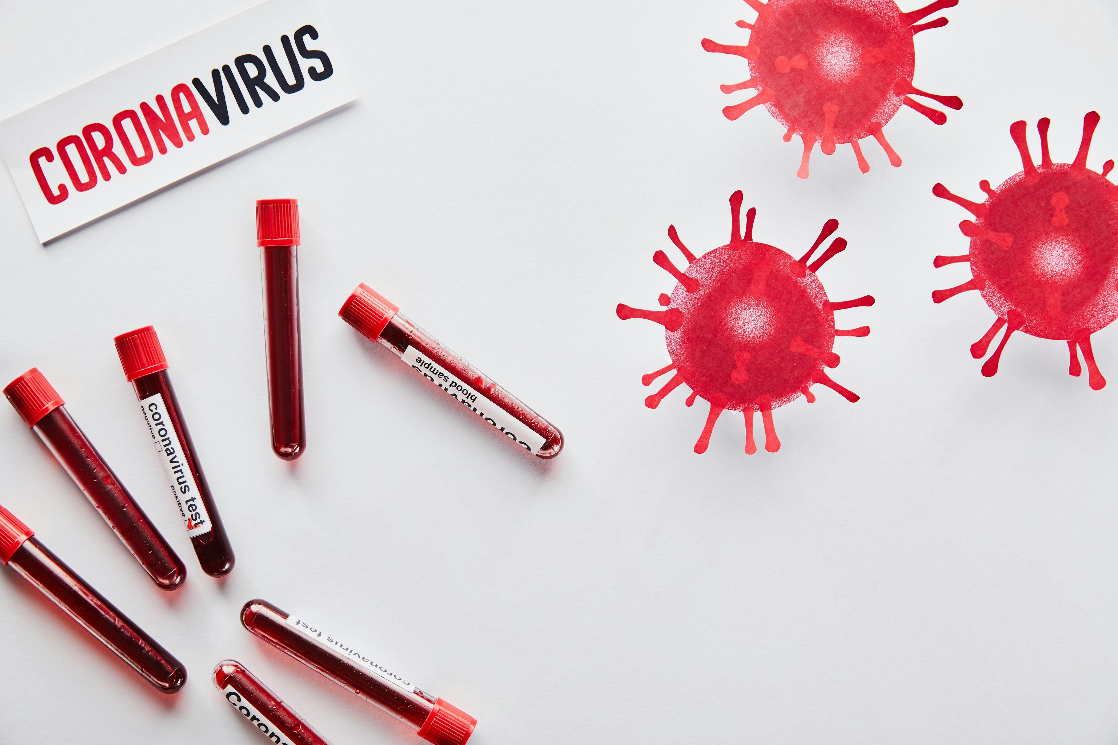 coronavirus, COVID-19, coronavirus testing, coronavirus test
