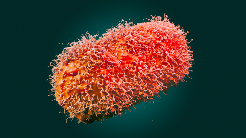 The U.S. Food and Drug Administration published this image of a colorized scanning electron micrograph of monkeypox virus (orange) on the surface of infected VERO E6 cells (green). The image is credited to the National Institute of Allergy and Infectious Diseases.