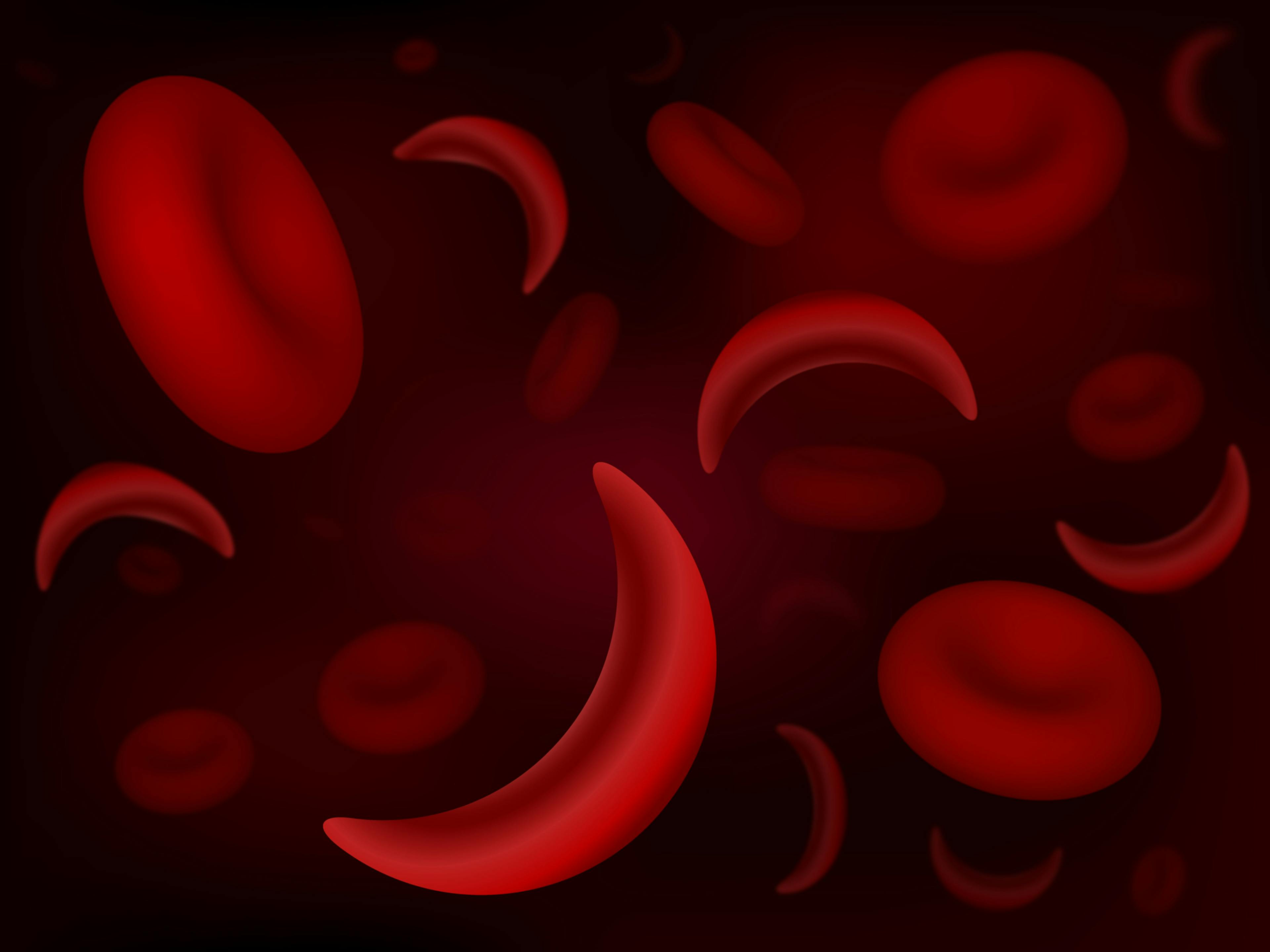 Sickle cell image ©extender_01-stock.adobe.com
