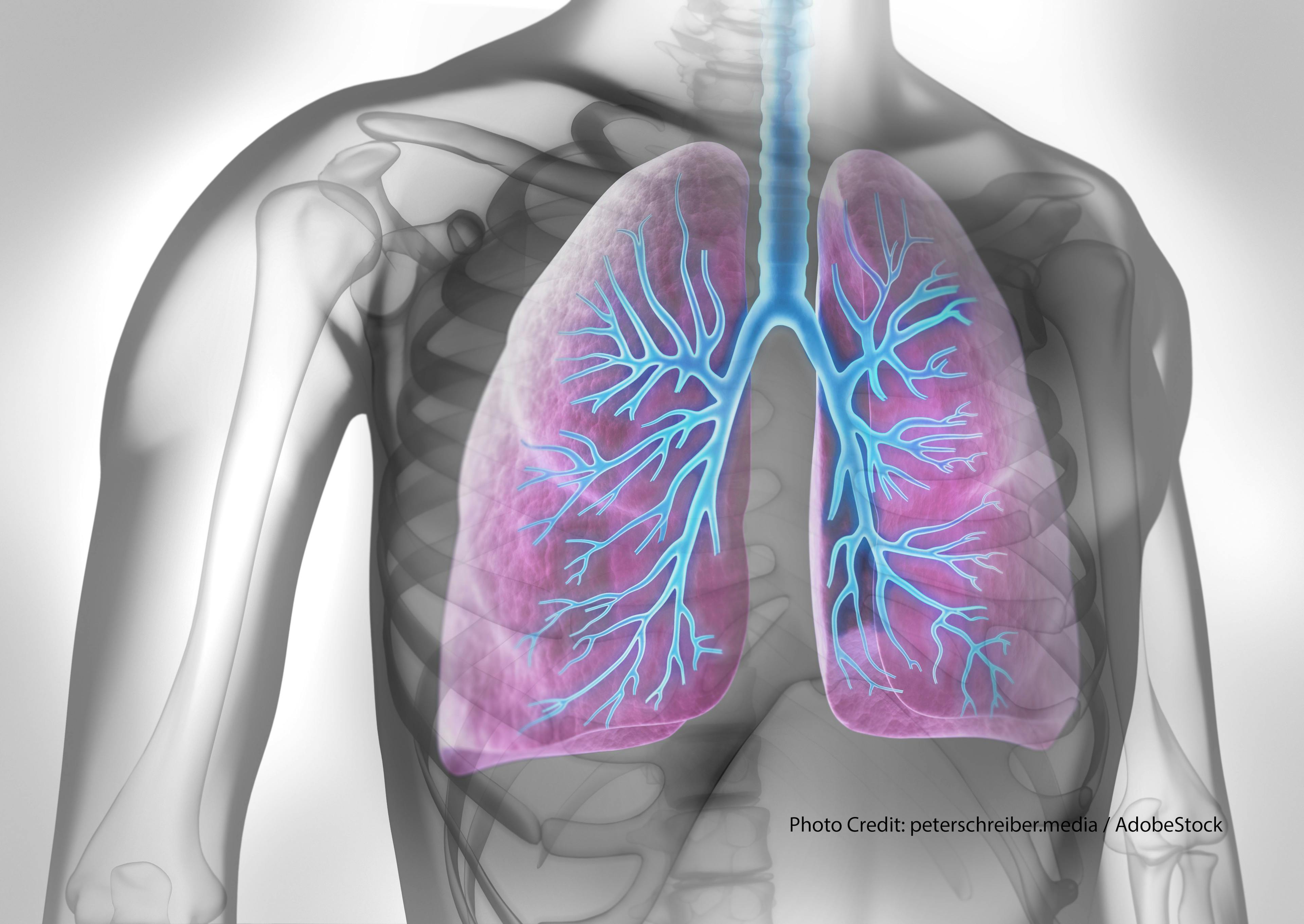 How to manage COPD patients