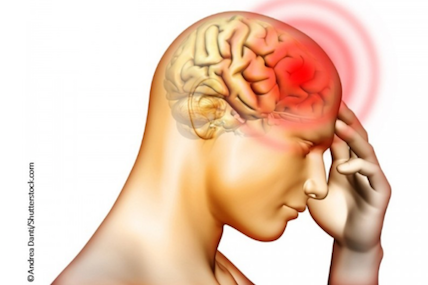 How to manage patients with migraines