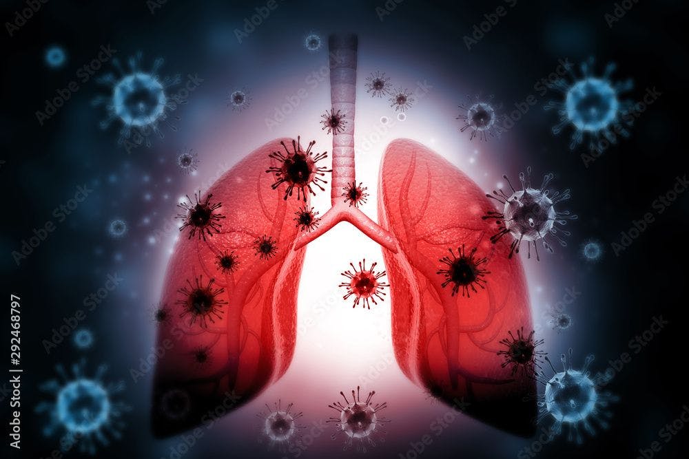 Image of lungs with virus ©Rasi stock.adobe.com