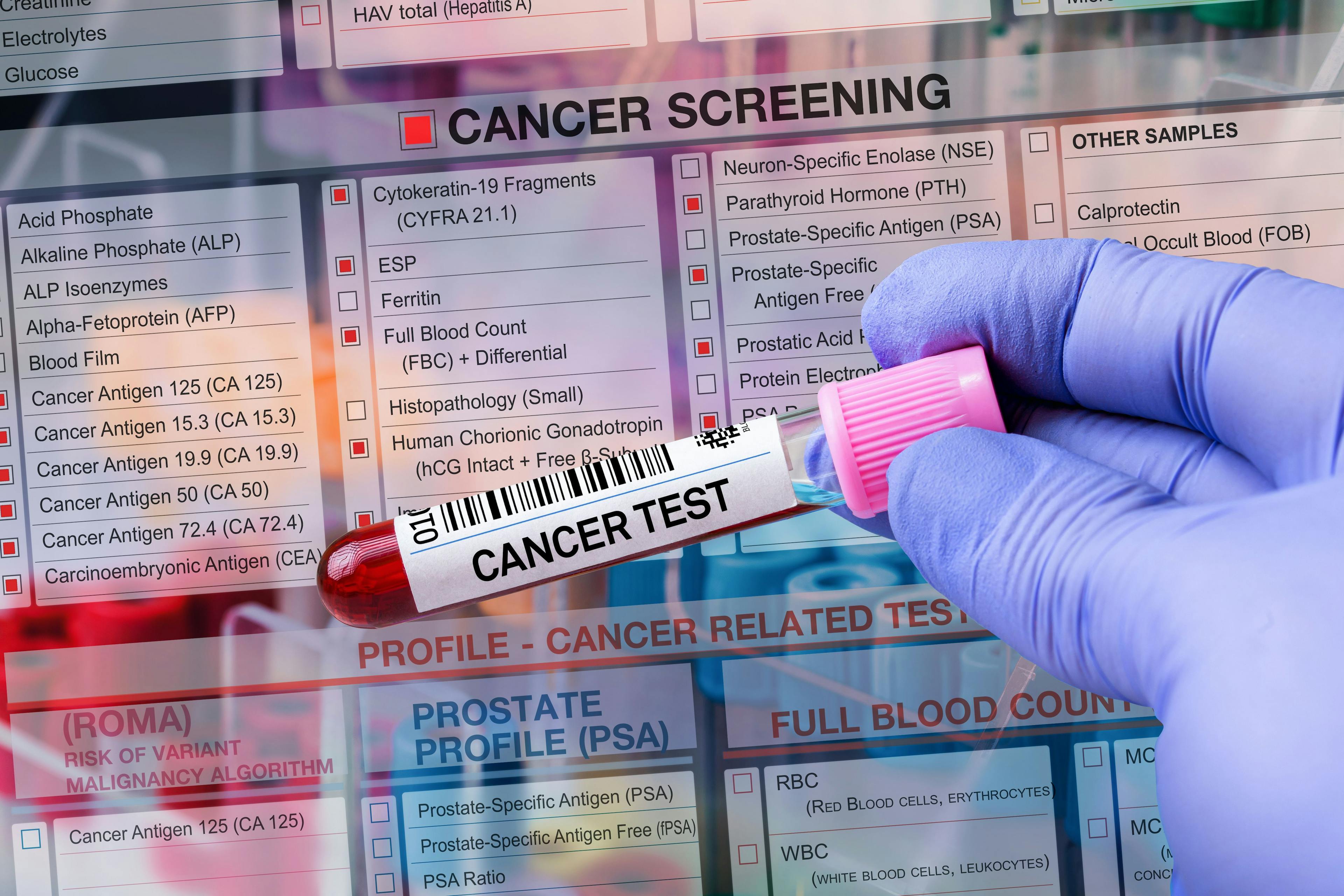 Blood sample with cancer test label ©angellodeco-stock.adobe.com