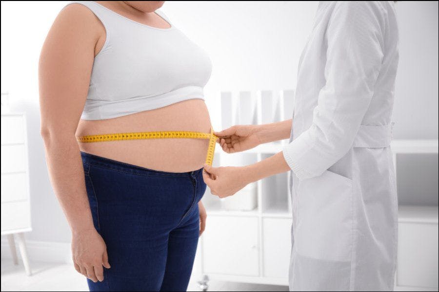 How to treat obese patients
