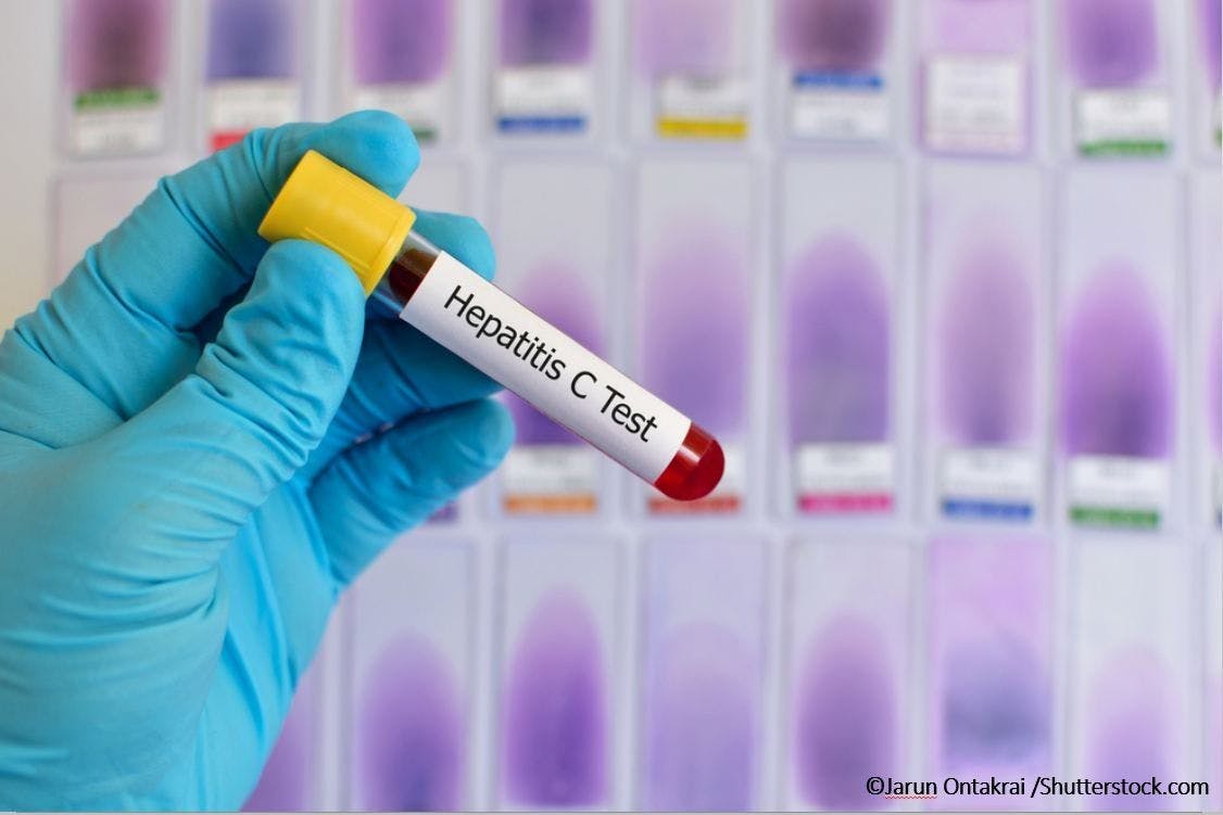 Direct-acting antiviral combination effective in hard-to-treat hepatitis C virus genotype 3