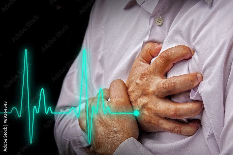 Heart attack outcomes vary widely among wealthy nations, study finds