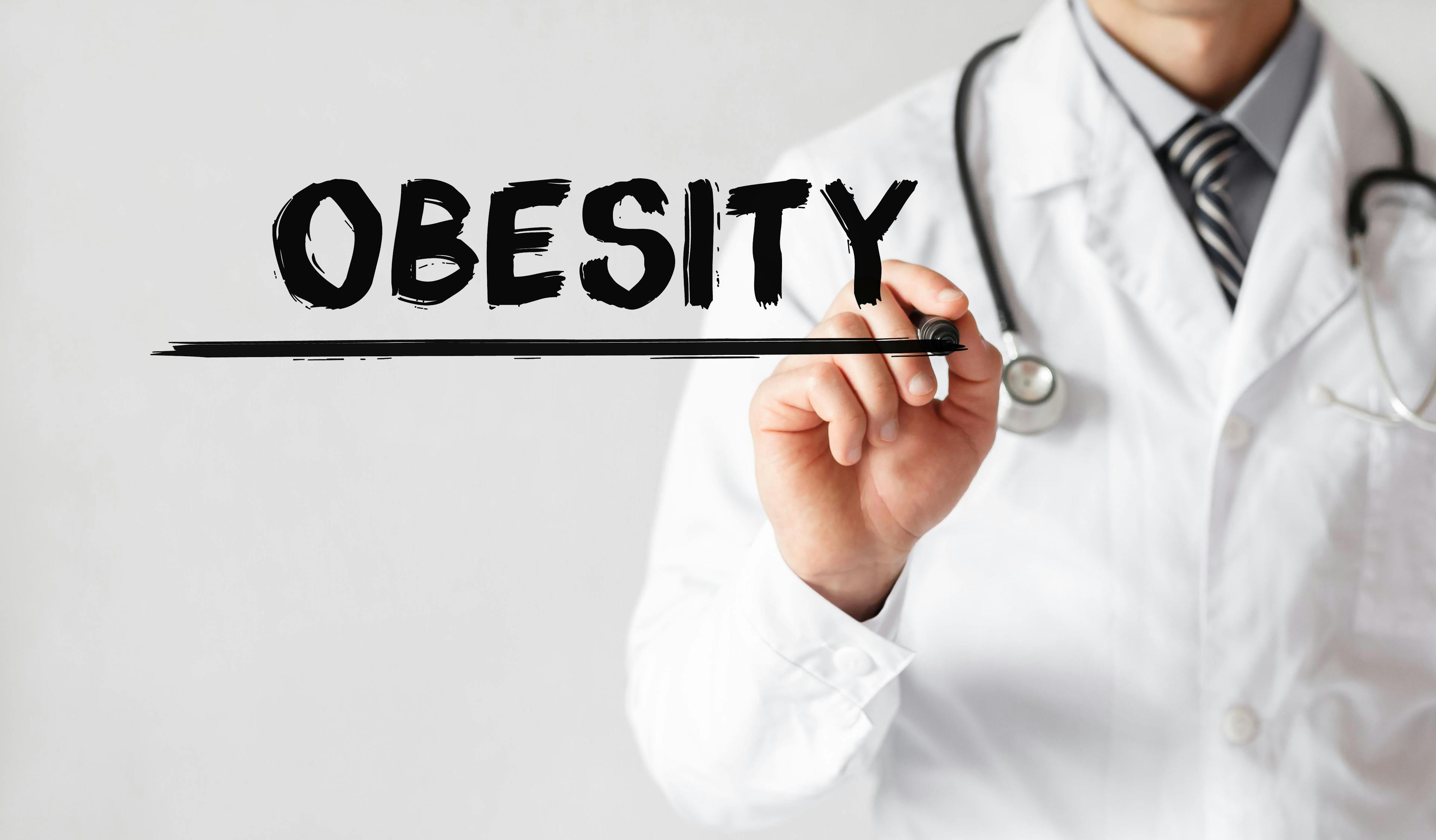 obesity, overweight concept